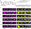 Intravital 2-photon microscopy of in vivo human H1299 lung cancers.