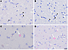 Representative IHC staining of HPgV in control and PD.