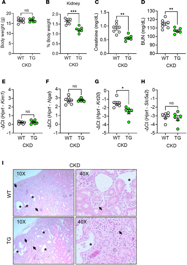 ERFE augmentation improves kidney function but does not alter injury mar...