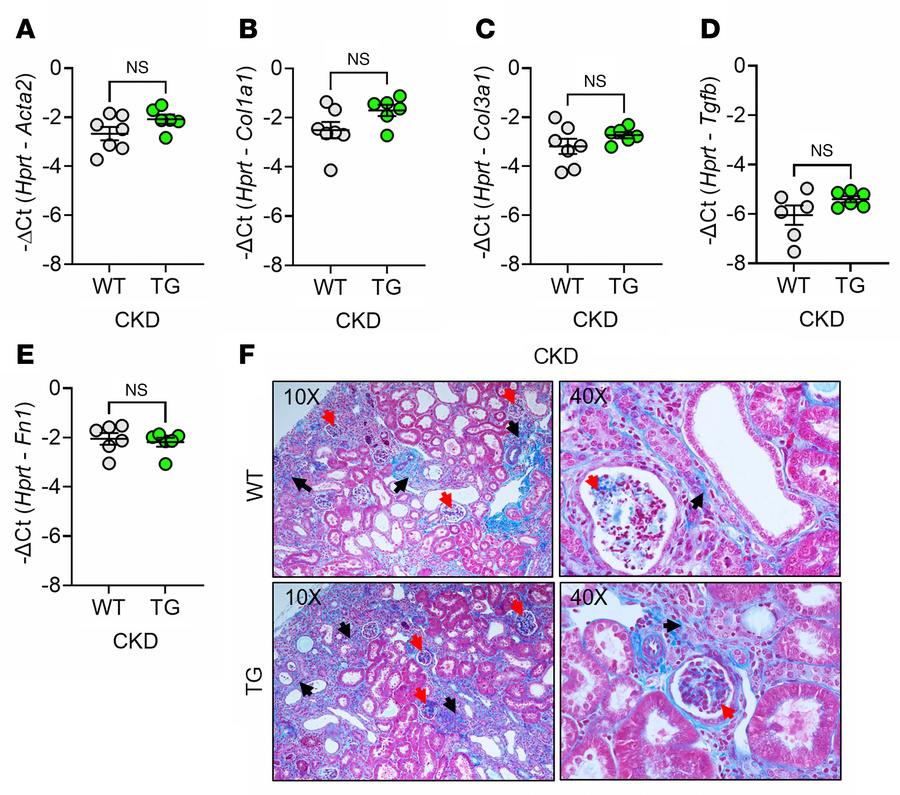 ERFE augmentation does not affect kidney fibrosis in adenine-induced CKD...