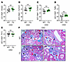 ERFE augmentation does not affect kidney fibrosis in adenine-induced CKD.