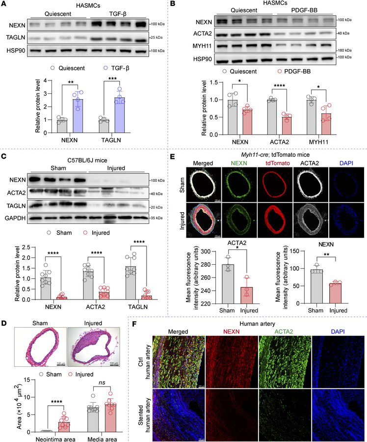 The expression of NEXN is significantly diminished during the processes ...