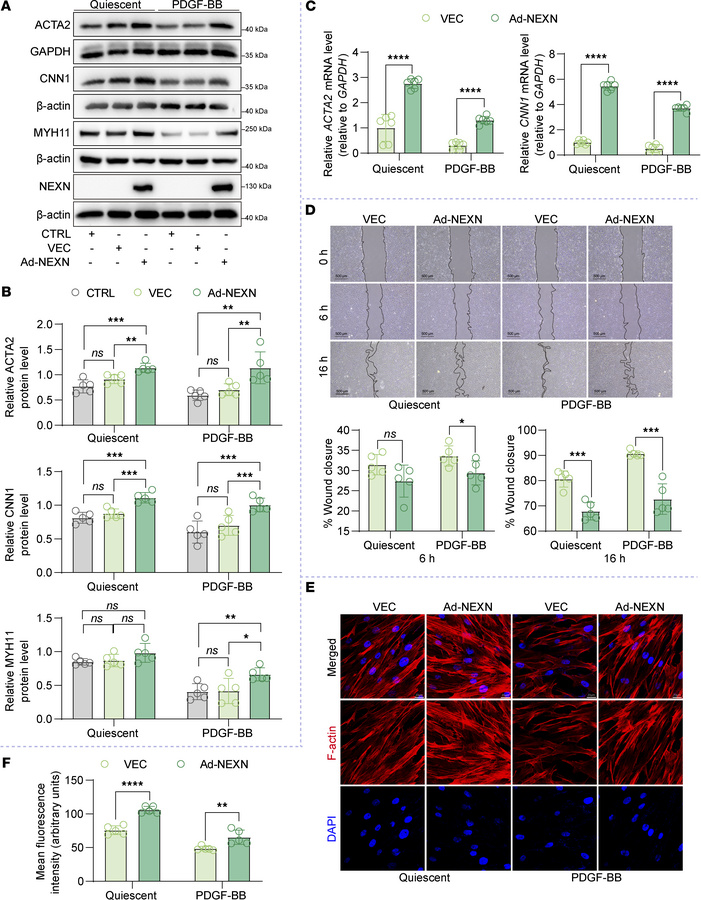NEXN maintains the contractile phenotype of VSMCs in vitro.
(A and B) Im...