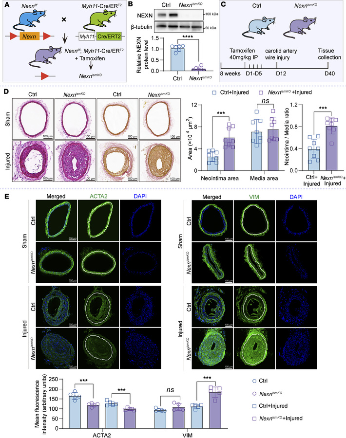 VSMC-specific deletion of NEXN aggravates neointima formation following ...