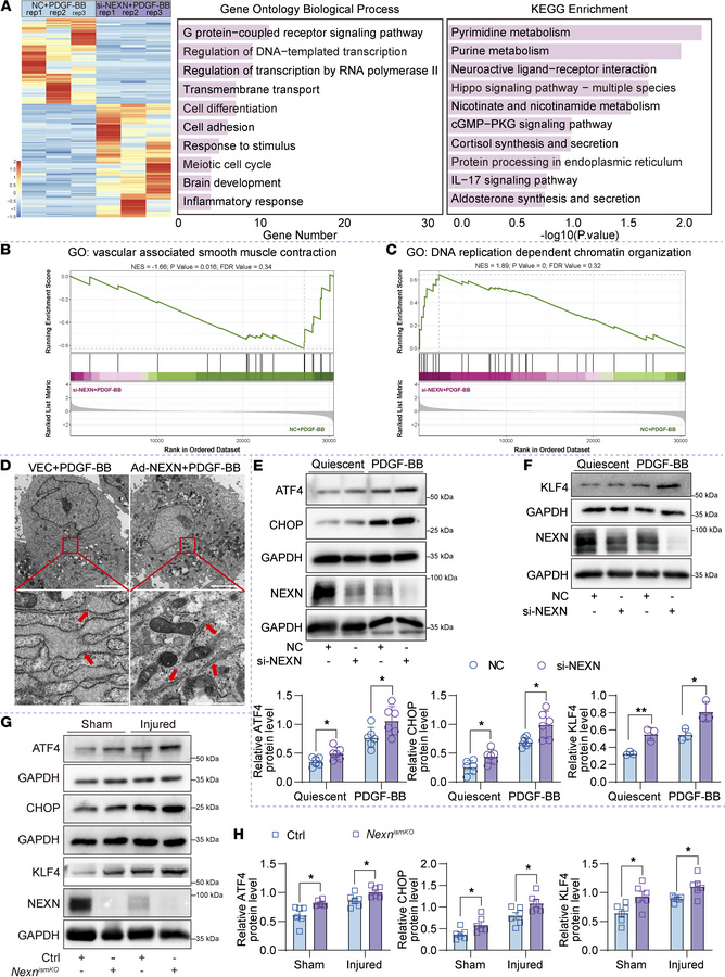 NEXN knockdown in VSMCs augments ER stress, modulating the VSMC phenotyp...