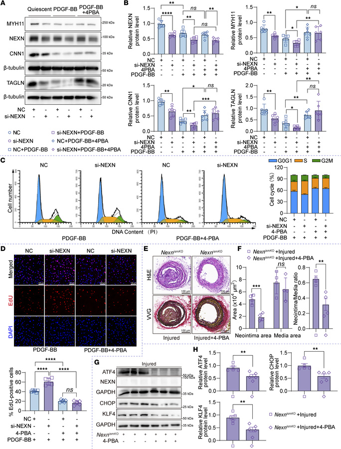 Inhibiting ER stress could ameliorate VSMC proliferation and phenotypic ...