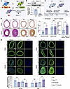 VSMC-specific deletion of NEXN aggravates neointima formation following vas
