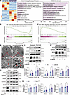 NEXN knockdown in VSMCs augments ER stress, modulating the VSMC phenotype v