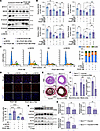 Inhibiting ER stress could ameliorate VSMC proliferation and phenotypic tra