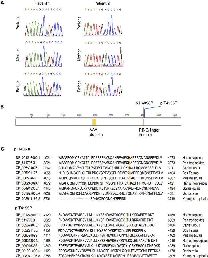 Sequence of RNF213.
De novo RNF213 variants were confirmed by Sanger seq...