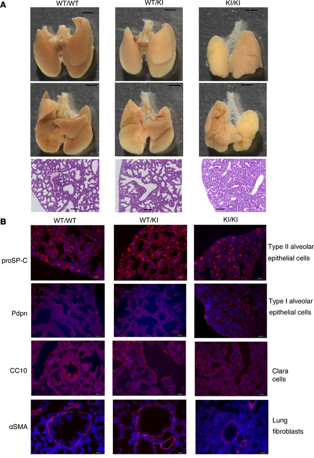 Phenotypic analysis of E18.5 Rnf213H4008P/H4008P mice reveals abnormal l...