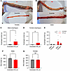 OTR knockdown leads to esophageal food retention.