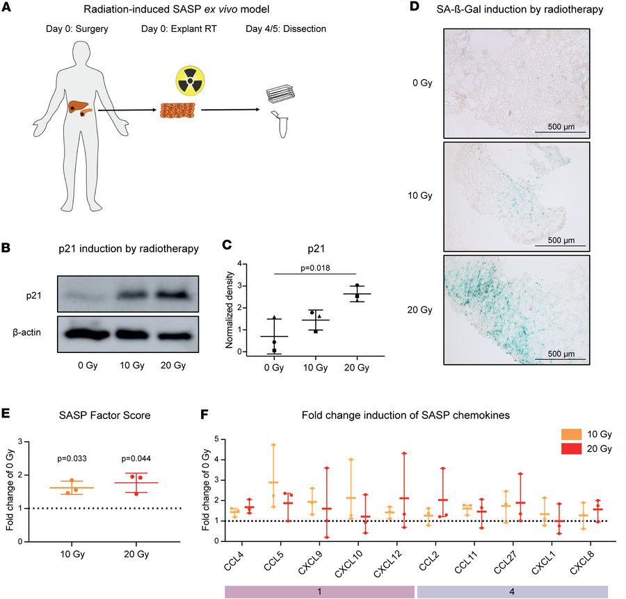 Photon irradiation induces modular SASP chemokine responses in an ex viv...