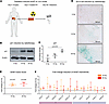 Photon irradiation induces modular SASP chemokine responses in an ex vivo p