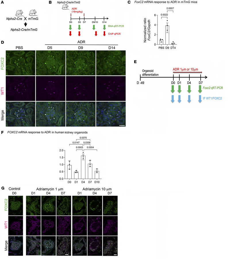 Time course of FOXC2 expression after injury in mice and human kidney or...