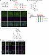 Time course of FOXC2 expression after injury in mice and human kidney organ