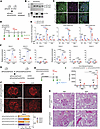 FOXC2 is required for the podocyte response to injury.