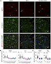 FOXC2 and WT1 in glomeruli of human kidneys.