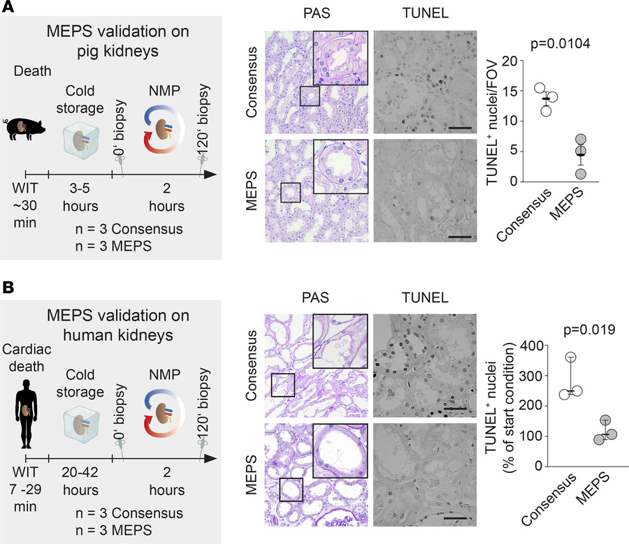 MEPS improves kidney cellular viability in pigs and humans.
(A) Pig kidn...
