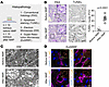 Histopathological injury and increased apoptosis during NMP.
