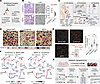 Pathology-oriented multiplexing reveals mechanisms of metabolic reprogrammi