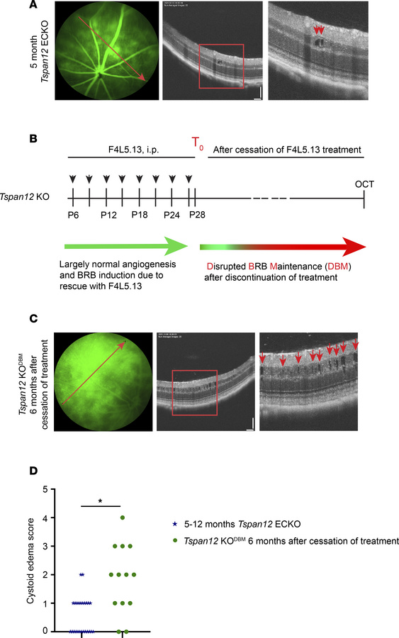 CE is more severe in Tspan12-KODBM mice compared with Tspan12-ECKO mice....