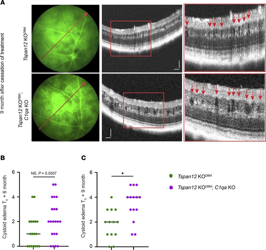 Increased CE in Tspan12-KODBM; C1qa-KO compound mutant retinas compared ...