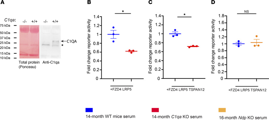 Loss of C1QA dampens ligand-independent basal β-catenin–dependent signal...