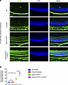 Increased IgG extravasation in Tspan12-KODBM; C1qa-KO compound mutant retin