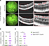 Increased CE in Tspan12-KODBM; C1qa-KO compound mutant retinas compared wit