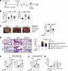 Bryostatin 1 ameliorates cedar-pollen-induced hay fever.
