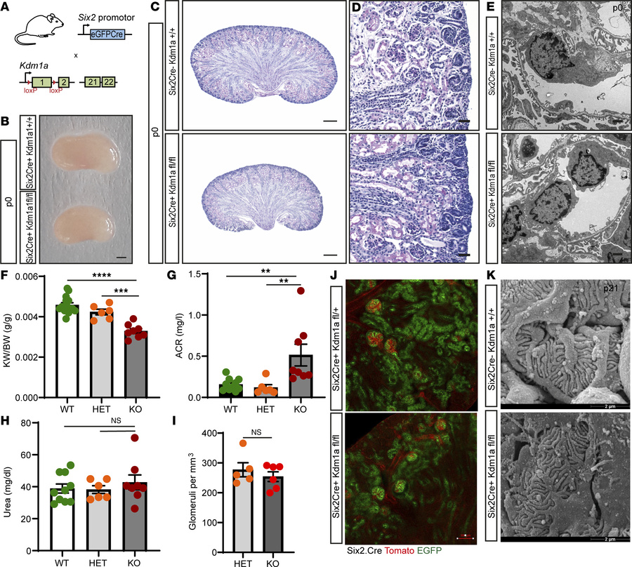 Conditional depletion of KDM1A leads to mild proteinuria and kidney hypo...