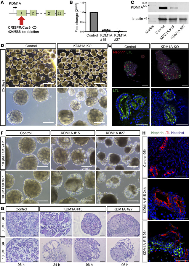 CRISPR/Cas9 LSD1 KO in human renal organoids leads to cyst formation.
(A...