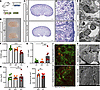Conditional depletion of KDM1A leads to mild proteinuria and kidney hypopla