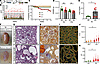 Loss of KDM1A during nephron formation induces massive changes in the adult