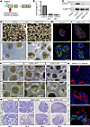 CRISPR/Cas9 LSD1 KO in human renal organoids leads to cyst formation.