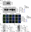 EFV reduces PrPres accumulation at the early clinical stage in sCJD-infecte