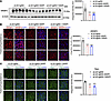 EFV treatment downregulates SREBF2 in the brains of sCJD-infected tg650 mic