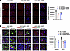 EFV treatment downregulates lipid droplet protein in the brains of sCJD-inf