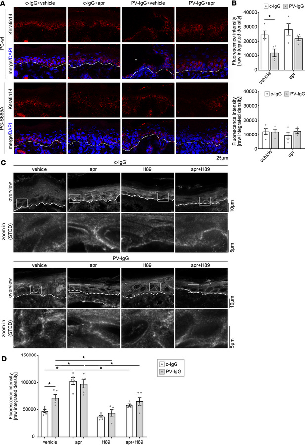 Apremilast abolishes PV-IgG–induced keratin alterations.
(A) Immunostain...