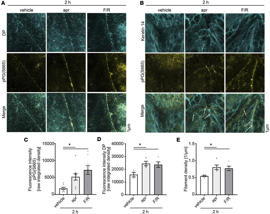 cAMP-mediated PG phosphorylation at S665 is important for proper keratin...