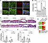 Phosphorylation of PG at S665 protects keratinocytes from PV-IgG–induced lo
