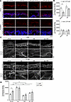 Apremilast abolishes PV-IgG–induced keratin alterations.
