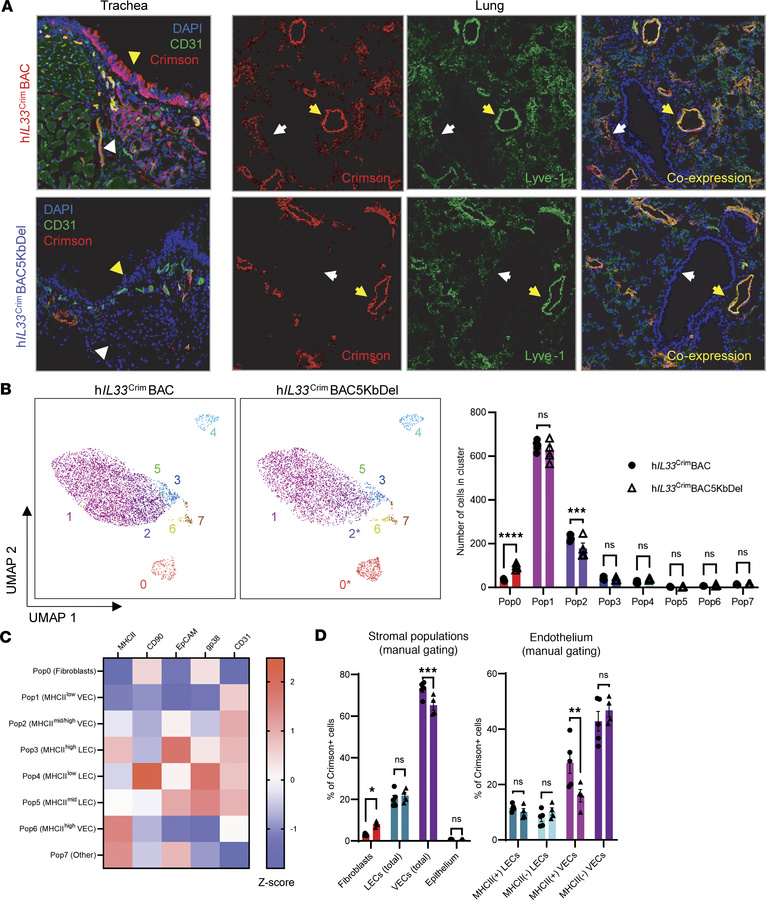 There is loss of Crimson expression in lung microvasculature of hIL33Cri...