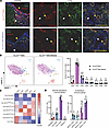 There is loss of Crimson expression in lung microvasculature of hIL33CrimBA