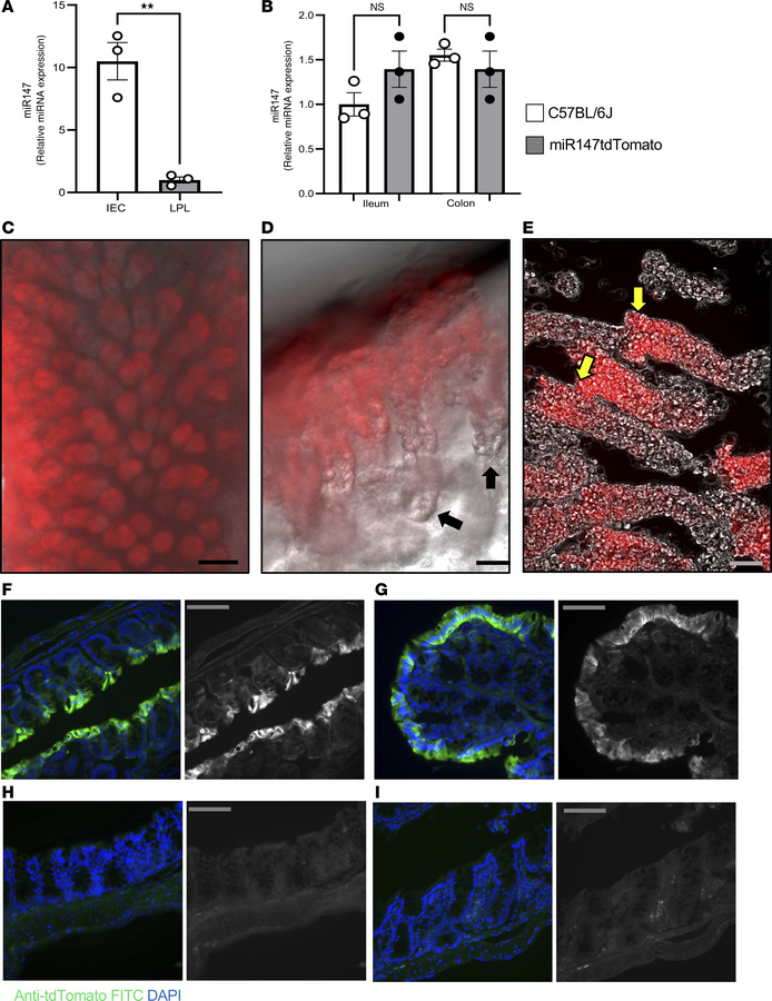 Luminal intestinal epithelial cells express high levels of miR147.
(A) C...