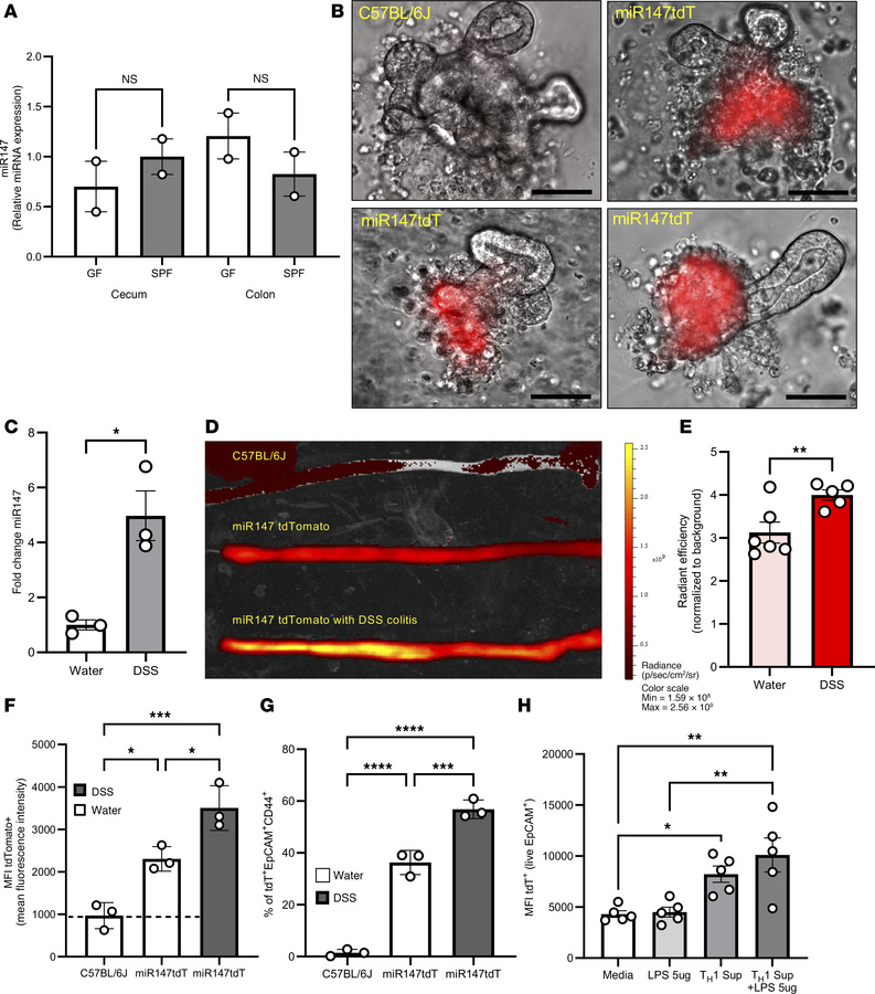 Intrinsic and extrinsic signals drive miR147 expression.
Colons and ceca...