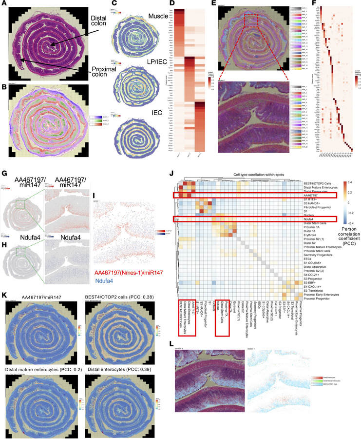 AA467197/miR147 and Ndufa4 define distinct epithelial cell populations i...
