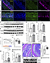Ndufa4 is a target of miR147 in intestinal epithelium.