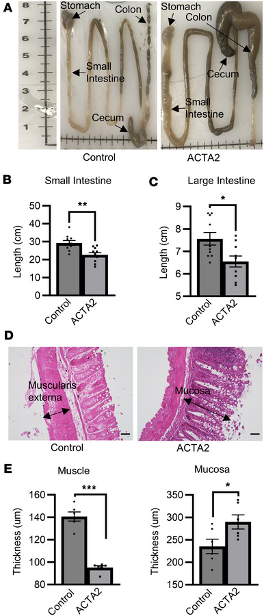 Altered gut architecture in ACTA2 mutant mice.
(A) Gross morphology of s...